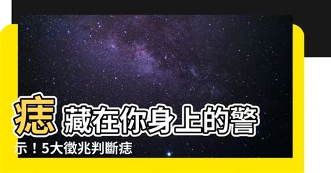 痣好壞|快檢查身體！痣長這裡致死率超高 醫曝5大判斷標準｜ 